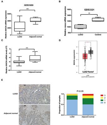 Monoamine Oxidase A Inhibits Lung Adenocarcinoma Cell Proliferation by Abrogating Aerobic Glycolysis